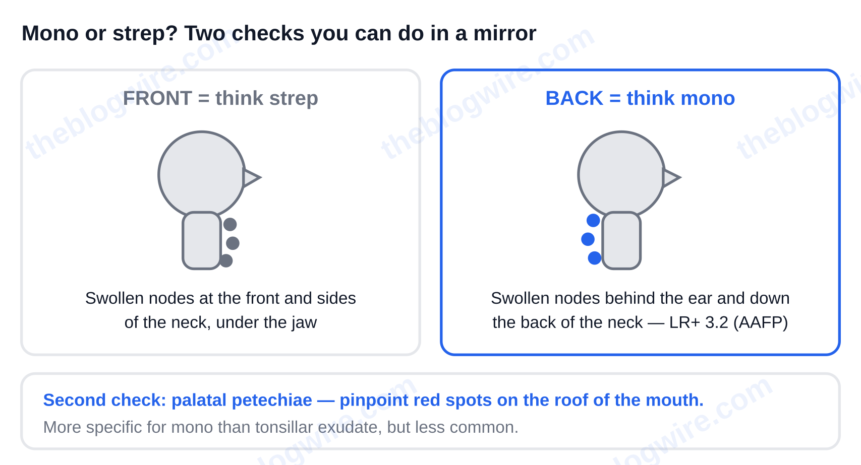 Mono versus strep self-check: swollen nodes at the front and sides of the neck under the jaw suggest strep, while swollen nodes at the back of the neck (posterior cervical lymphadenopathy, LR+ 3.2) suggest mono; the second check is palatal petechiae on the roof of the mouth — first symptoms of mono